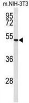 EFEMP2 antibody, GTX80452, GeneTex, Western Blot image 