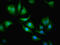 Carbonic Anhydrase 1 antibody, CSB-PA004364HA01HU, Cusabio, Immunofluorescence image 