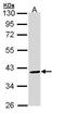 Bone Morphogenetic Protein 15 antibody, GTX110245, GeneTex, Western Blot image 