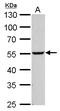 Nicotinamide Phosphoribosyltransferase antibody, GTX128980, GeneTex, Western Blot image 