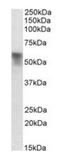 Serpin Family A Member 6 antibody, orb22532, Biorbyt, Western Blot image 