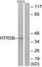 5-hydroxytryptamine receptor 5B antibody, TA315779, Origene, Western Blot image 