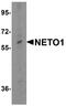 Neuropilin And Tolloid Like 1 antibody, A08303, Boster Biological Technology, Western Blot image 