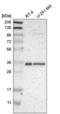 Heterogeneous Nuclear Ribonucleoprotein A1 antibody, NBP2-58898, Novus Biologicals, Western Blot image 