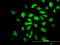 Calcium/Calmodulin Dependent Protein Kinase II Alpha antibody, LS-C196810, Lifespan Biosciences, Immunofluorescence image 