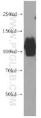 ELKS/RAB6-Interacting/CAST Family Member 2 antibody, 21396-1-AP, Proteintech Group, Western Blot image 