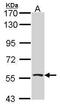 Aldehyde Dehydrogenase 7 Family Member A1 antibody, GTX114274, GeneTex, Western Blot image 