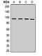 Mismatch repair endonuclease PMS2 antibody, LS-C667972, Lifespan Biosciences, Western Blot image 