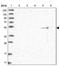 TSPY Like 6 antibody, NBP2-33977, Novus Biologicals, Western Blot image 