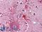 Apoptotic Peptidase Activating Factor 1 antibody, LS-B3340, Lifespan Biosciences, Immunohistochemistry paraffin image 
