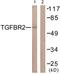 Transforming Growth Factor Beta Receptor 2 antibody, TA311643, Origene, Western Blot image 