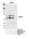 LIM Domain And Actin Binding 1 antibody, NB100-2310, Novus Biologicals, Western Blot image 