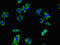 Transforming Growth Factor Beta Receptor 1 antibody, CSB-PA023451LA01HU, Cusabio, Immunofluorescence image 