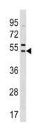 Sorting Nexin 5 antibody, abx034740, Abbexa, Western Blot image 