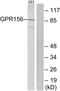 G Protein-Coupled Receptor 156 antibody, PA5-39622, Invitrogen Antibodies, Western Blot image 