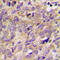 Protein Tyrosine Kinase 2 Beta antibody, abx133123, Abbexa, Western Blot image 