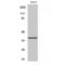 Aurora Kinase B antibody, LS-C382135, Lifespan Biosciences, Western Blot image 
