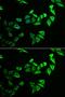 Myozenin 2 antibody, GTX32734, GeneTex, Immunofluorescence image 