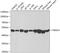 Proteasome 26S Subunit, ATPase 4 antibody, 18-674, ProSci, Western Blot image 