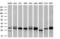 Thiopurine S-Methyltransferase antibody, GTX83498, GeneTex, Western Blot image 