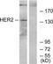 ERBB2 antibody, TA312245, Origene, Western Blot image 