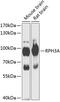 Rabphilin 3A antibody, 15-087, ProSci, Western Blot image 