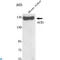 Angiotensin I Converting Enzyme antibody, LS-C812869, Lifespan Biosciences, Western Blot image 
