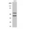 Matrix Metallopeptidase 10 antibody, LS-C380502, Lifespan Biosciences, Western Blot image 