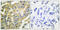 Keratin 8 antibody, A01421S73, Boster Biological Technology, Immunohistochemistry paraffin image 