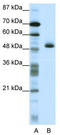 Zinc Finger Protein 213 antibody, TA343444, Origene, Western Blot image 