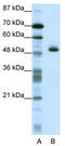 Zinc Finger Protein 213 antibody, TA343444, Origene, Western Blot image 