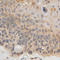 Interferon Beta 1 antibody, A1575, ABclonal Technology, Immunohistochemistry paraffin image 