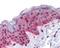 Polo Like Kinase 1 antibody, GTX104302, GeneTex, Immunohistochemistry paraffin image 