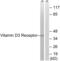Vitamin D Receptor antibody, abx012944, Abbexa, Western Blot image 