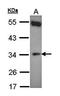 Cytochrome B5 Reductase 1 antibody, orb69815, Biorbyt, Western Blot image 