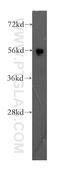 Signal Regulatory Protein Gamma antibody, 11857-1-AP, Proteintech Group, Western Blot image 