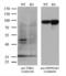 Thyroid Hormone Receptor Alpha antibody, LS-C790536, Lifespan Biosciences, Western Blot image 