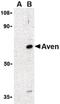 Apoptosis And Caspase Activation Inhibitor antibody, PA5-20288, Invitrogen Antibodies, Western Blot image 