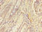 Endoplasmic Reticulum-Golgi Intermediate Compartment 1 antibody, LS-C371757, Lifespan Biosciences, Immunohistochemistry paraffin image 