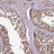 ZFP69 Zinc Finger Protein B antibody, HPA044289, Atlas Antibodies, Immunohistochemistry paraffin image 