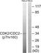 Cyclin Dependent Kinase 1 antibody, LS-C198773, Lifespan Biosciences, Western Blot image 