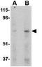 MAPK Associated Protein 1 antibody, GTX31312, GeneTex, Western Blot image 