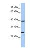 Chromosome 12 Open Reading Frame 42 antibody, NBP1-70431, Novus Biologicals, Western Blot image 