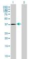 Pantothenate Kinase 3 antibody, H00079646-B01P, Novus Biologicals, Western Blot image 