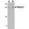 Transmembrane And Immunoglobulin Domain Containing 1 antibody, MBS153436, MyBioSource, Western Blot image 