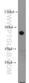 Interferon Induced Protein With Tetratricopeptide Repeats 3 antibody, 15201-1-AP, Proteintech Group, Western Blot image 