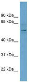Chromobox protein homolog 2 antibody, TA344361, Origene, Western Blot image 