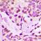 Histone Deacetylase 8 antibody, orb256589, Biorbyt, Immunohistochemistry paraffin image 