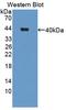 CHL1 antibody, LS-C714768, Lifespan Biosciences, Western Blot image 