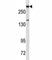 Dicer 1, Ribonuclease III antibody, F53587-0.1ML, NSJ Bioreagents, Western Blot image 